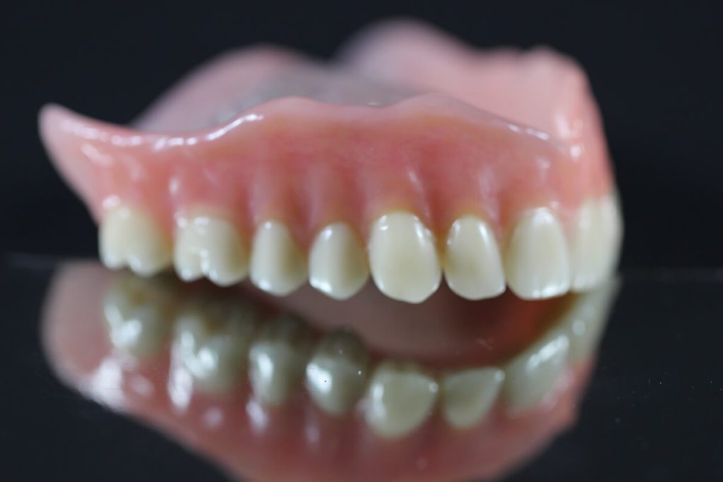 partial dentures anderson