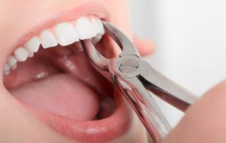 a woman getting a tooth extraction