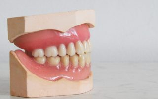 teeth and gums