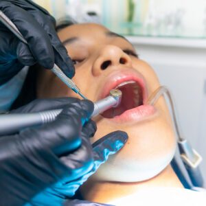 dentist working on patients teeth
